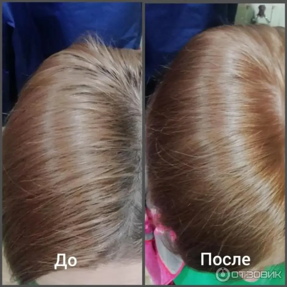 Эстель 8 65