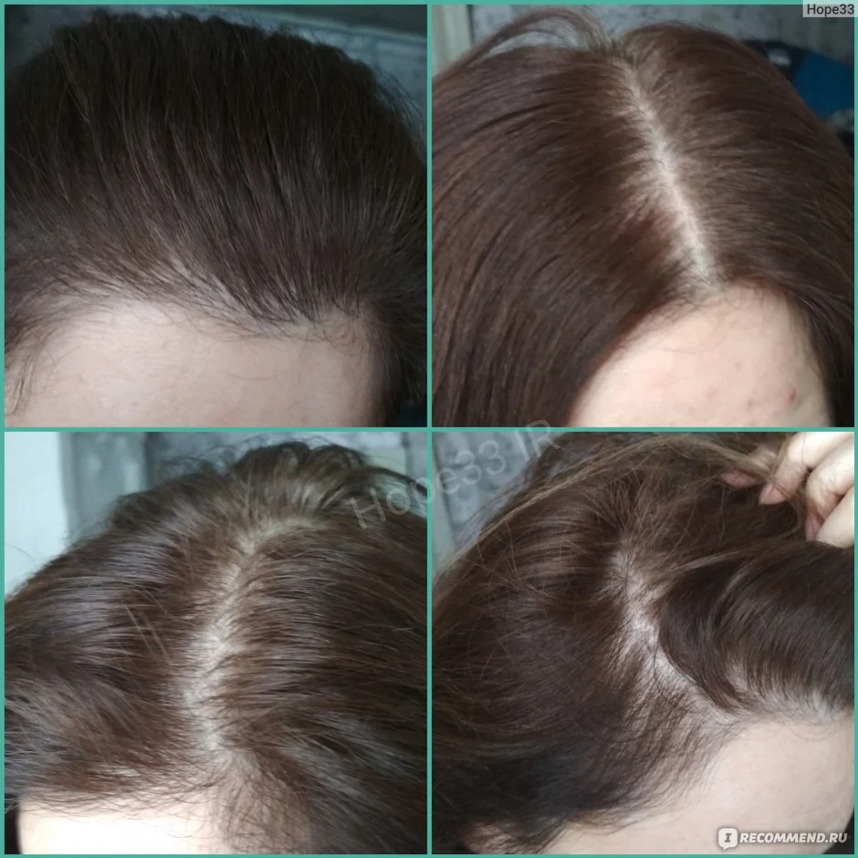 Kapous hyaluronic