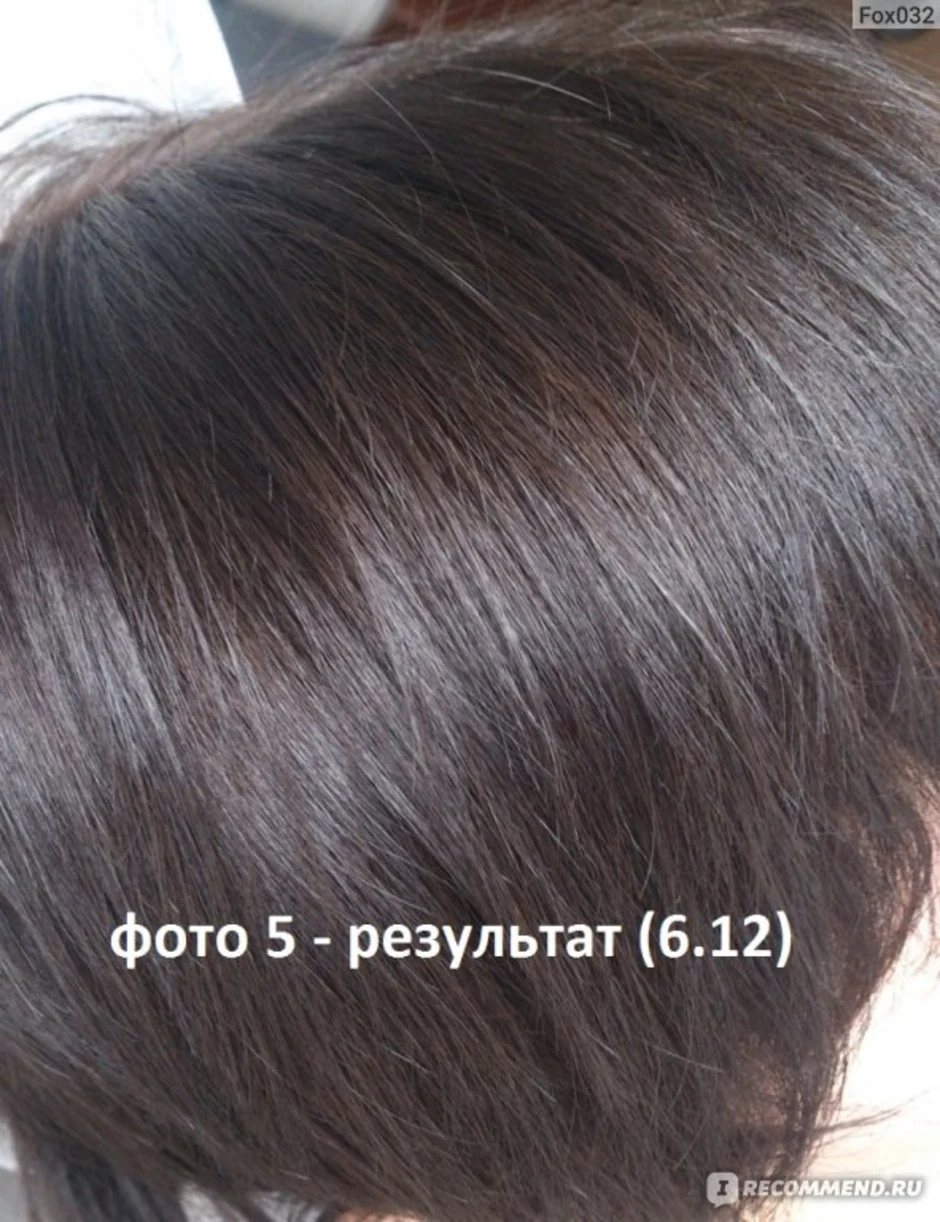 Igora 6.12 + 7.1