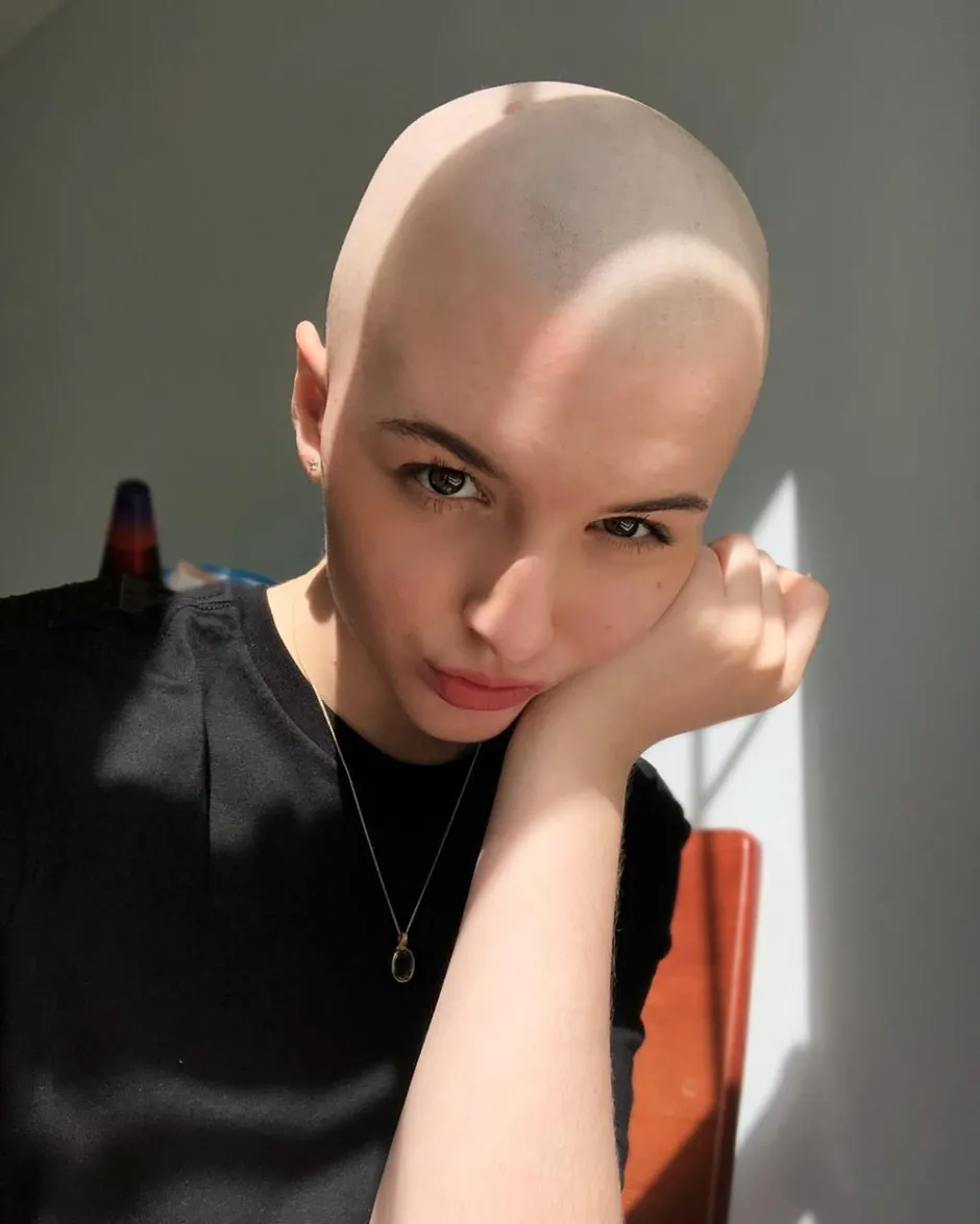 Лысые прически