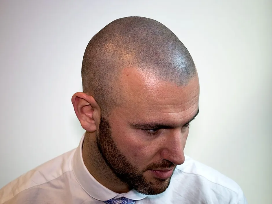 First buzzcut 5 mm