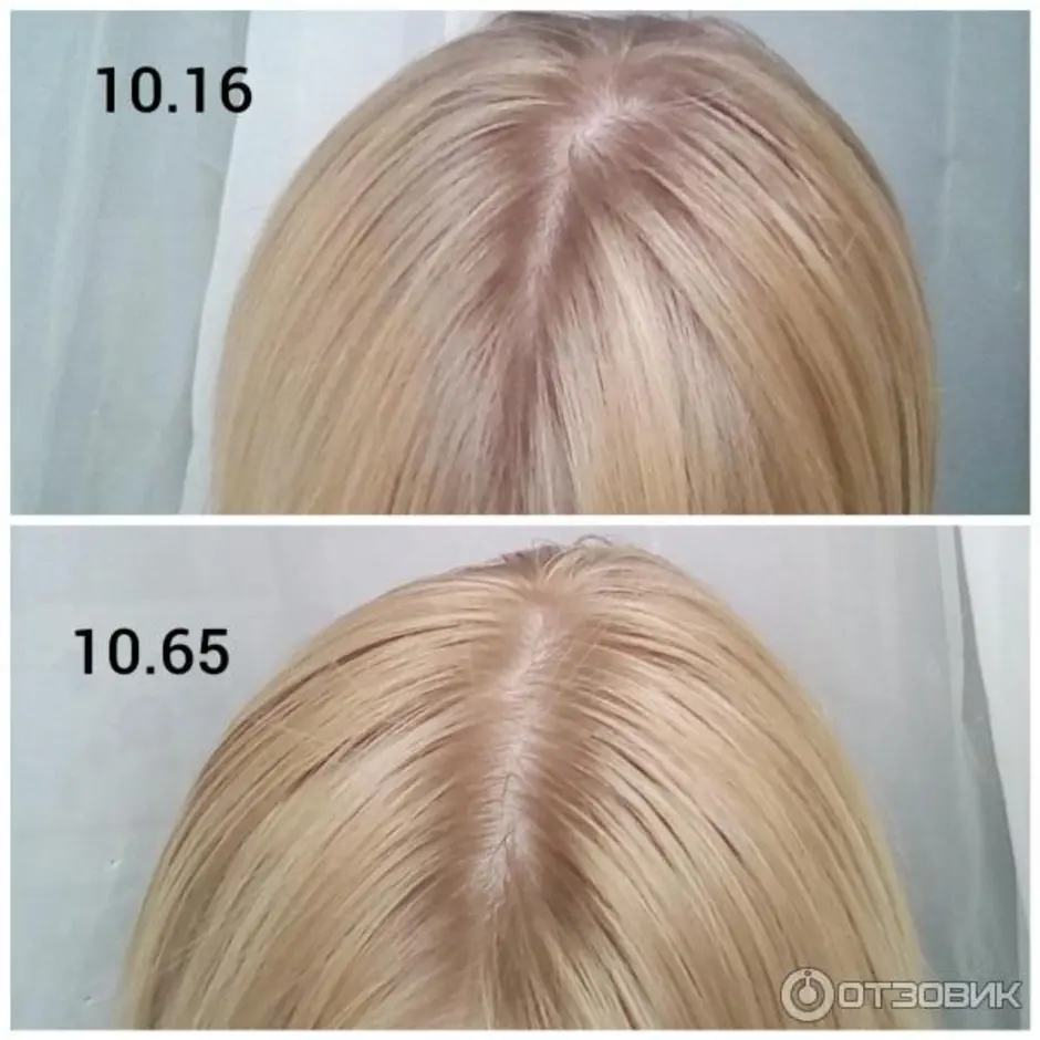 Эстель 10 16 до и после