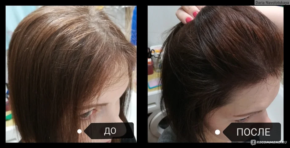 Эстель 7 0