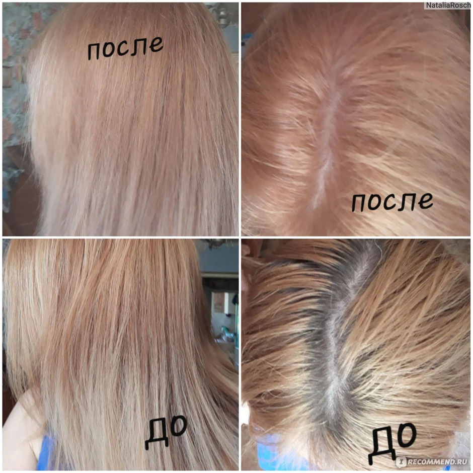 10/65 эстель делюкс