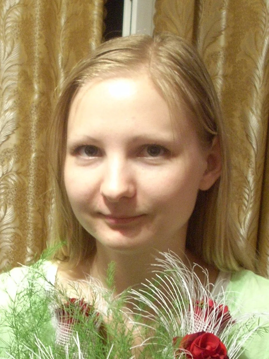 Жидкие волосы у девушки