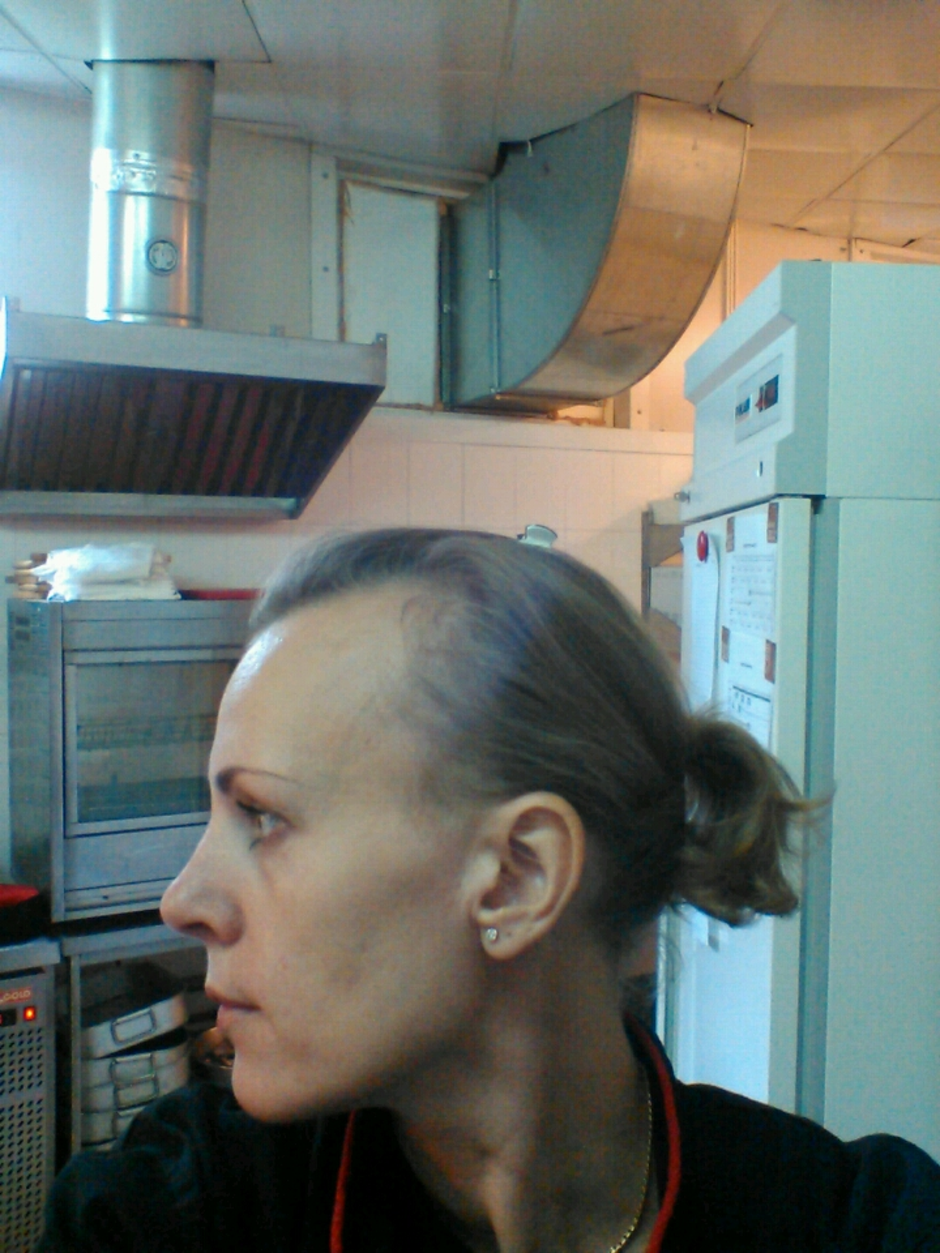Очень тонкие и редкие волосы