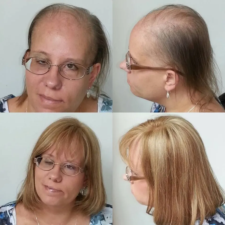 Система волос hair talk