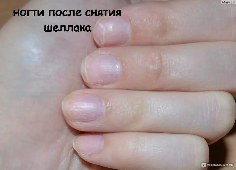 Покрытие ногтей после снятия гель лака