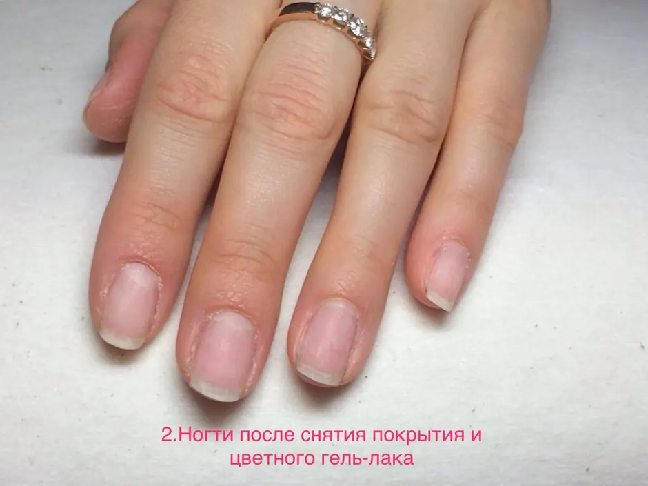 Восстановление ногтей после гель лака