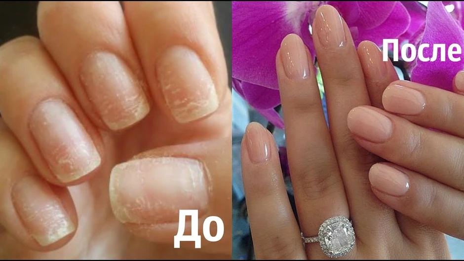 Восстановление ногтей после гель лака
