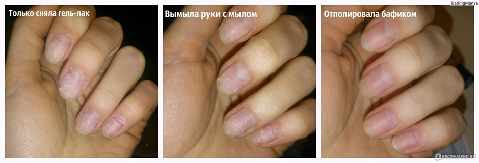 Восстановление ногтей после гель лака