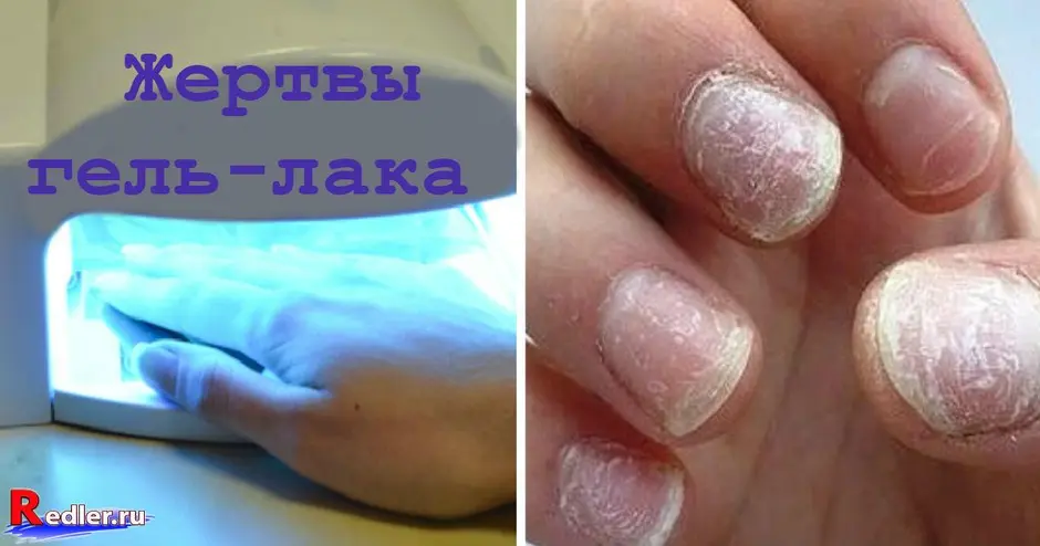 Ногти после снятия гель лака