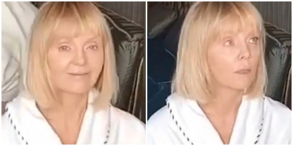 Звезды без фотошопа и макияжа