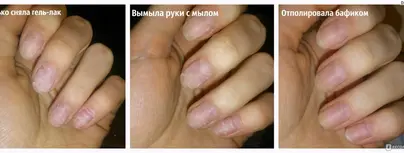 Ногти после шеллака фото